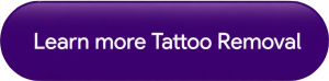 Learn more tattoo removal Hull